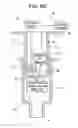 Fig. 10 - Syringe with energy delivery component and method of use