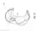 Fig. 14 - Patient interfaces