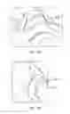 Fig. 27 - Patient interfaces