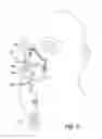 Fig. 06 - Strapless nasal interface device