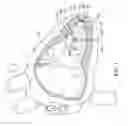 Fig. 02 - Leadless delivery catheter with conductive pathway