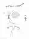 Fig. 02 - Medical device delivery system and methods of use
