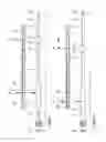 Fig. 02 - Endovascular mobile balloon support catheter
