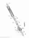 Fig. 04 - Endovascular mobile balloon support catheter