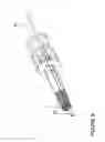 Fig. 09 - Endovascular mobile balloon support catheter