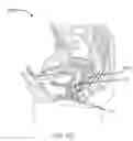 Fig. 08 - VAGINAL REJUVENATION METHODS AND DEVICES