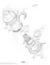 Fig. 02 - Medical devices and methods for fluid transfer