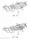 Fig. 06 - Flexible circuit electrode array with wire or film support