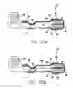 Fig. 22 - Flexible circuit electrode array with wire or film support