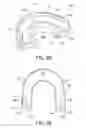 Fig. 04 - Oral device with activating element