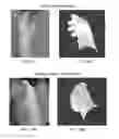 Fig. 09 - Systems for neural bridging of the nervous system