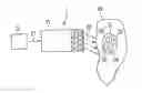 Fig. 01 - Device and method for effective invasive two-stage neurostimulation