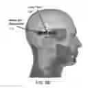 Fig. 07 - Earpiece assembly to interact with implantable neural stimulators