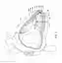 Fig. 02 - Fixation methods for leadless cardiac devices