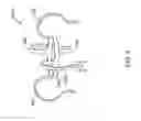 Fig. 05 - Fixation methods for leadless cardiac devices
