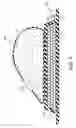 Fig. 05 - Radiation shielding implants and methods of use