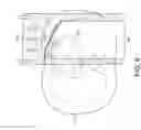 Fig. 07 - Radiation shielding implants and methods of use
