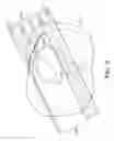 Fig. 08 - Radiation shielding implants and methods of use