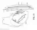 Fig. 12 - Radiation shielding implants and methods of use