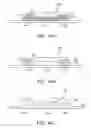 Fig. 13 - Radiation shielding implants and methods of use