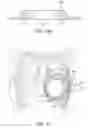 Fig. 14 - Radiation shielding implants and methods of use