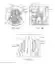 Fig. 08 - Radiosurgical neuromodulation devices, systems, and methods for treatment of behavioral disorders by external application of ionizing radiation