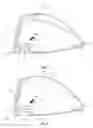 Fig. 10 - Golf club head