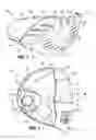 Fig. 02 - Mixed material golf club head