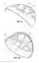 Fig. 07 - Mixed material golf club head