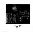 Fig. 35 - Microfluidic devices