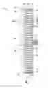 Fig. 01 - Abrasive-means holding device