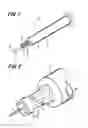 Fig. 02 - SYRINGE WITH NEEDLE