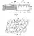 Fig. 05 - Process for manufacturing textured laminate sheet