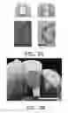 Fig. 06 - Photothermal modification of plasmonic structures