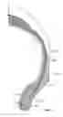 Fig. 04 - TIRE HAVING A CONDUCTIVE INSERT