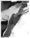 Fig. 07 - Beltevator