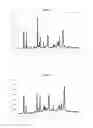 Fig. 02 - Crystalline forms of cadazolid
