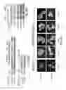 Fig. 06 - STAT3 dimerization inhibitors