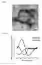 Fig. 05 - Heparin-binding cationic peptide self-assembling peptide amphiphiles useful against drug-resistant bacteria