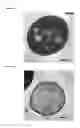 Fig. 30 - Heparin-binding cationic peptide self-assembling peptide amphiphiles useful against drug-resistant bacteria