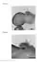 Fig. 31 - Heparin-binding cationic peptide self-assembling peptide amphiphiles useful against drug-resistant bacteria