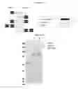 Fig. 02 - Serpin fusion polypeptides and methods of use thereof