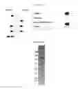 Fig. 09 - Serpin fusion polypeptides and methods of use thereof