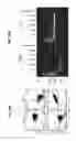 Fig. 15 - Blockade of CD7 expression and chimeric antigen receptors for immunotherapy of T-cell malignancies
