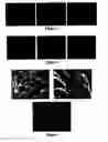 Fig. 02 - Method of crosslinking of polysaccharides using photoremovable protecting groups