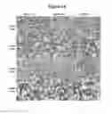 Fig. 13 - Modulation of BCL11A for treatment of hemoglobinopathies