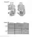Fig. 14 - Modulation of BCL11A for treatment of hemoglobinopathies