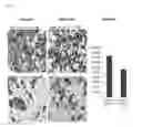 Fig. 03 - Device and method to treat esophageal disorders