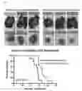 Fig. 05 - Device and method to treat esophageal disorders