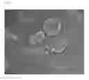 Fig. 06 - Device and method to treat esophageal disorders